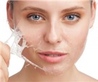 5 cách bảo vệ làn da của bạn trong mùa hè