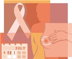 7 lời đồn thổi về ung thư vú
