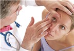 Bệnh đau mắt đỏ: Phòng dễ hơn chữa