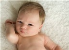 Bé sơ sinh không có mống mắt, điều trị thế nào?