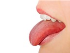 Bị đau ở bên phải lưỡi khi nói có phải bị ung thư lưỡi?