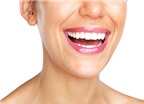 Cách chỉnh răng cho nụ cười xinh
