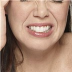 Có cách nào khắc phục chứng nghiến răng?