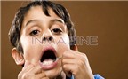 Dạy trẻ về sức khỏe răng miệng (P1)