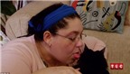 Kỳ lạ: Một phụ nữ nghiện ăn lông mèo