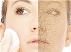 Một số bệnh ảnh hưởng tới làn da của bạn