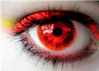 Những nguyên nhân không ngờ có thể gây bệnh đau mắt đỏ