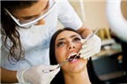 Phương pháp dán răng Veneer sứ là gì?