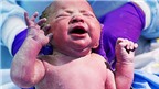 Trẻ sơ sinh nhẹ cân có nguy cơ vô sinh khi trưởng thành