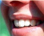 Tự tẩy trắng răng dễ gây hỏng răng