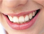 Tại sao nên thường xuyên lấy cao răng