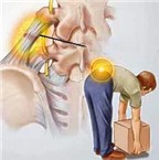 Phòng và trị chứng đau lưng