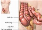 Trẻ đau bụng bất thường: Coi chừng viêm ruột thừa