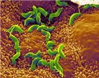 Phương pháp phát hiện vi khuẩn Helicobacter Pylori