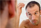 Thuốc chống rụng tóc khiến giảm ham muốn