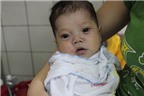 Nhịp thở khó khăn của bé 7 tháng tuổi bị bệnh tim bẩm sinh