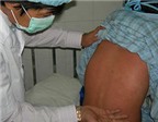 Phương pháp mới giúp phát hiện thai nhi nhiễm rubella