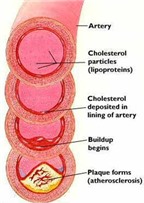 Cách nào giảm cholesterol (mỡ máu)?