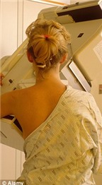 Phát hiện ung thư vú chính xác không cần X-quang