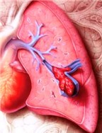 Hiểm họa do nghẽn mạch phổi