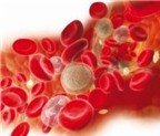 Bệnh ung thư máu: Chẩn đoán và điều trị