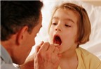 Dấu hiệu nhận biết trẻ bị viêm amiđan