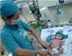 Khó tách thành công bé sơ sinh 2 đầu ở Sóc Trăng
