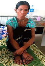 Hoảng hồn với những bệnh lạ ở Việt Nam