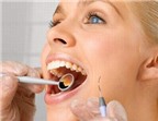 Cách phòng bệnh răng miệng ở người cao tuổi