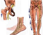 Hội chứng chân không nghỉ: nguyên nhân, biểu hiện và điều trị