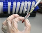 Thử máu phát hiện bệnh di truyền cho bào thai
