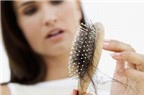 4 loại thuốc chữa rụng tóc