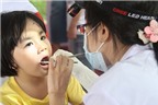 Trẻ em có nên tẩy trắng răng?