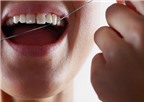 Niềng răng, căng thẳng... dễ gây các bệnh về lợi