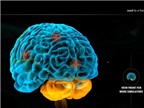 Chấn thương sọ não có gây bệnh não nước?