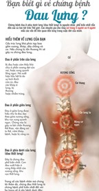 Những điều nên biết về bệnh đau lưng