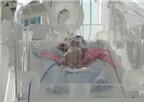 Bé sơ sinh suýt bị chôn sống giảm cân so với lúc mới vào viện