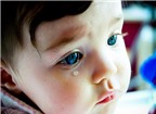 Khi ngáp bé chảy nhiều nước mắt là bệnh gì?
