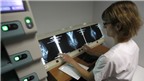 Nên sàng lọc ung thư vú bằng chụp X-Quang ở tuổi nào?