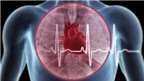 Nguy cơ tim mạch của các thuốc NSAID không chọn lọc