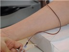 Cách xét nghiệm máu  giúp phát hiện 85%  ung thư ruột