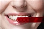 Sau tiểu phẫu răng khôn, vệ sinh răng miệng thế nào?