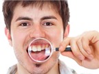 Răng không đều, chỉnh cách nào nhanh nhất?
