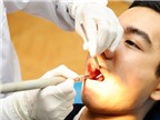Nguyên nhân răng đau nhức dữ dội, sưng tấy sau đặt thuốc diệt tủy?