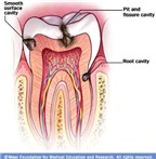 Triệu chứng viêm quanh răng