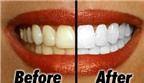 8 cách làm răng trắng hơn