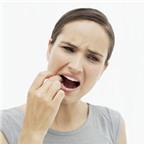 Bệnh chảy máu chân răng và cách phòng ngừa