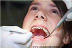Răng đen- chữa bằng cách nào?