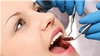 Bí quyết để “giải tán” chứng nghiến răng