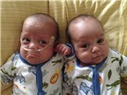 Hai bé trai song sinh chào đời cách nhau 39 ngày